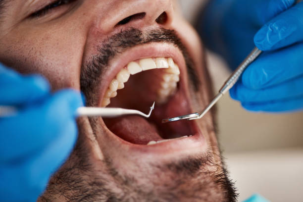 Best Emergency Gum Treatment in Northvale, NJ